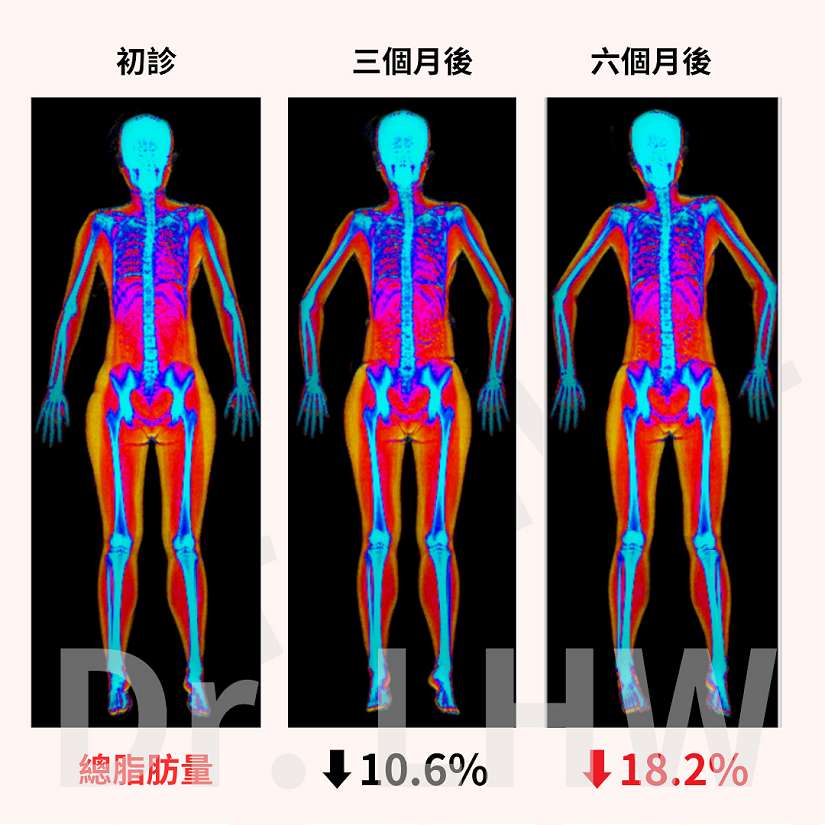 精準醫療 窈窕身材不是夢